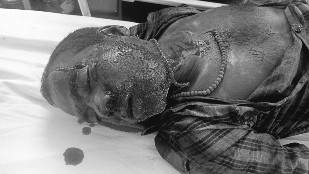 Jamshedpur : कदमा रंकिणी मंदिर के सामने तेज रफ्तार वाहन ने युवक को मारी टक्कर, मौत