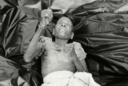 Saraikela : तिरुलडीह में दर्दनाक हादसा, कुएं में गिरने से बुजुर्ग महिला की मौत